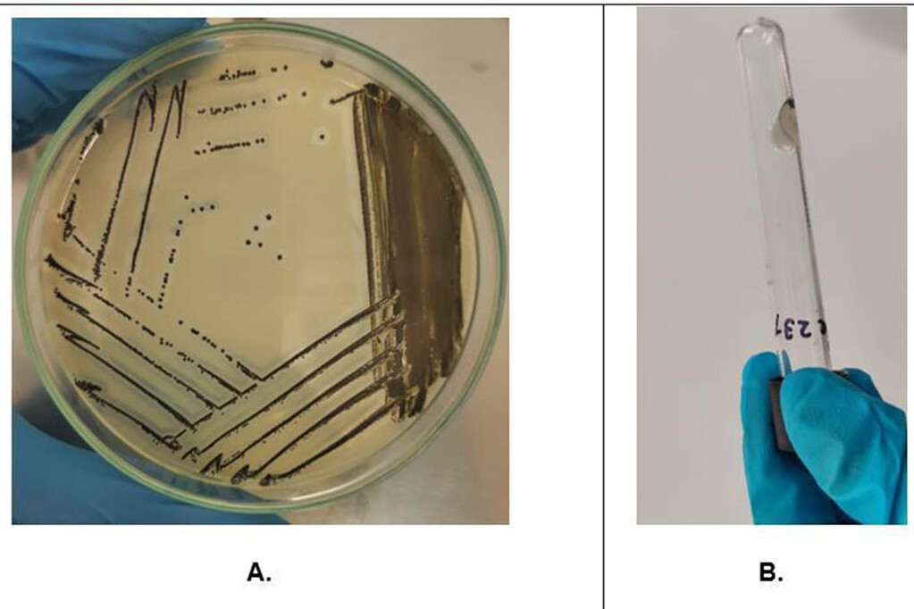 Pruebas de detección de bacterias en la leche